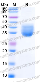 Recombinant Human CD352/SLAMF6 Protein, C-His