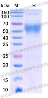 Recombinant Human CD217/IL17RA Protein, C-His