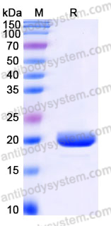 Recombinant Human IL17F Protein, N-His
