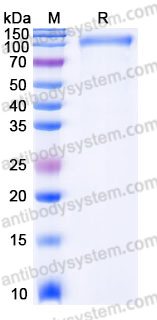 Recombinant Human OSMR/IL-31RB Protein, C-His