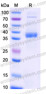 Recombinant Human CD158d/KIR2DL4 Protein, C-His