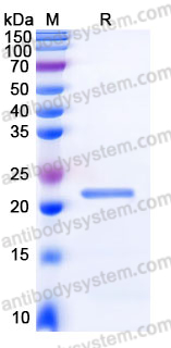 Recombinant Human TIMP4 Protein, C-His