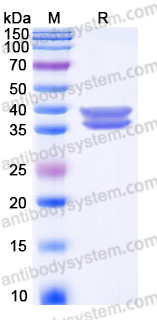 Recombinant Human GPA33 Protein, C-His