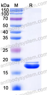 Recombinant Human RARRES2 Protein, C-His