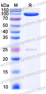 Recombinant Human SEMA3C Protein, C-His