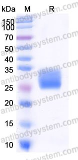 Recombinant Human IL22 Protein, C-His