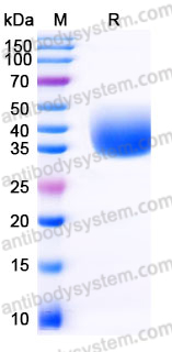 Recombinant Human CXCL16 Protein, C-His