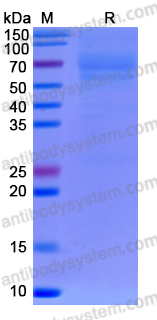 Recombinant Human DPEP3 Protein, C-His