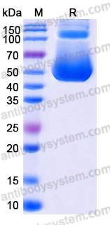 Recombinant Human CD318/CDCP1 Protein, C-His