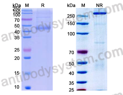 Recombinant Human MMRN2 Protein, C-His