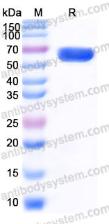 Recombinant Human SIAE Protein, C-His