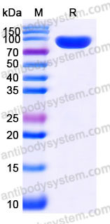 Recombinant Human IL1RL2/IL-36R Protein, C-Fc