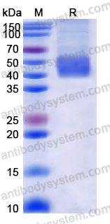 Recombinant Human CD360/IL21R Protein, C-His