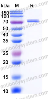 Recombinant Human CD229/LY9 Protein, C-His