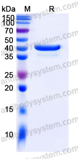Recombinant Human RETN/Resistin Protein, C-Fc