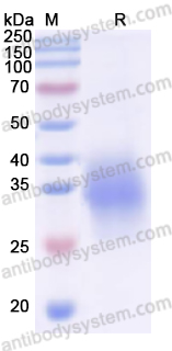 Recombinant Human CD354/TREM1 Protein, C-His