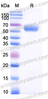 Recombinant Human IL1RAP Protein, C-His