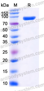 Recombinant Human SEMA4B Protein, C-His