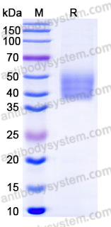 Recombinant Human IL17RB Protein, C-His