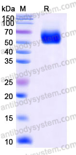 Recombinant Human IL1RAPL1 Protein, C-His
