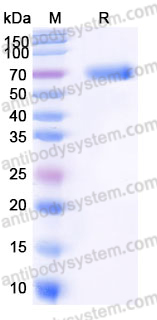 Recombinant Human DKK3 Protein, C-His