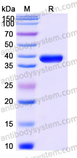 Recombinant Human CTSZ Protein, C-His