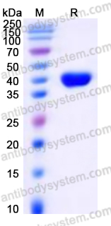 Recombinant Human KLK11 Protein, C-His