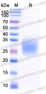 Recombinant Human CD300a Protein, C-His