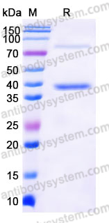 Recombinant Human STEAP1 Protein, N-Flag & C-His