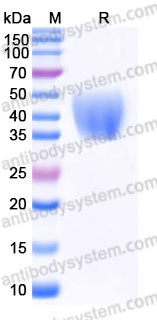 Recombinant Human IL20RA Protein, C-His