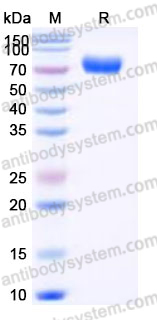 Recombinant Human IL20RA Protein, C-Fc