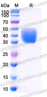 Recombinant Human CD84/SLAMF5 Protein, C-His