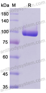 Recombinant Human PADI4 Protein, N-Strep