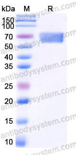 Recombinant Human HYOU1 Protein, C-10*His