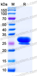 Recombinant Human FKBP7 Protein, C-His