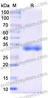 Recombinant Human IgA Fc region Protein