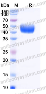 Recombinant Human IgM/IGHM Protein, C-His