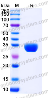 Recombinant Human TWSG1 Protein, C-His
