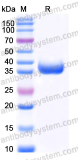 Recombinant Human ERP27 Protein, C-His