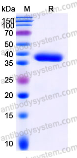 Recombinant Human C1QTNF1 Protein, C-His