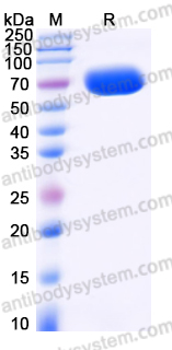 Recombinant Human CNDP1 Protein, C-His