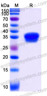 Recombinant Human CLMP Protein, C-His