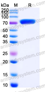 Recombinant Human FLRT1 Protein, C-His
