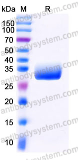Recombinant Human KLK4 Protein, C-His