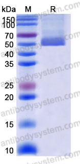 Recombinant Human SERPINA12 Protein, C-10*His