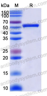 Recombinant Human FETUB Protein, C-His