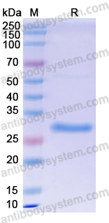 Recombinant Human Lambda light chain Protein, C-His
