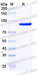 Recombinant Human VSIG4/CRIg Protein, C-Fc