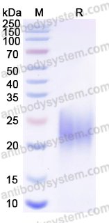 Recombinant Human TMIGD2/CD28H/IGPR1 Protein, C-His