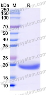 Recombinant Human TREML1/TLT1 Protein, C-His